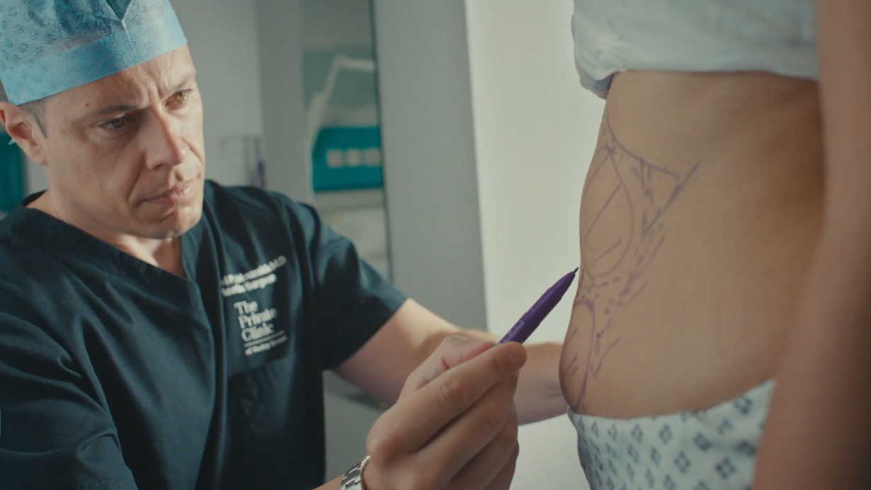Body procedures
