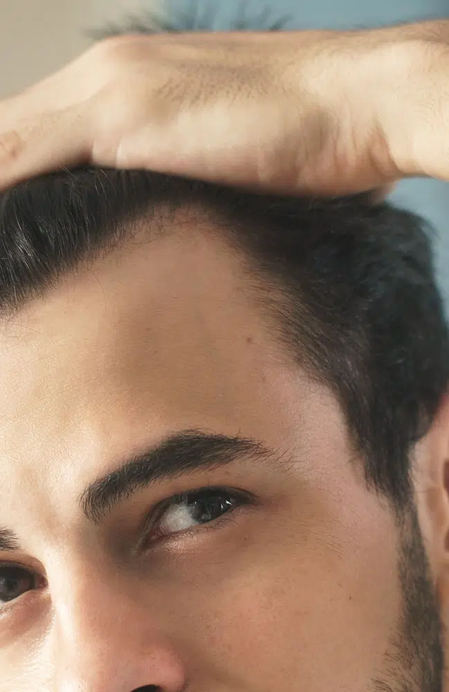 Hair procedures